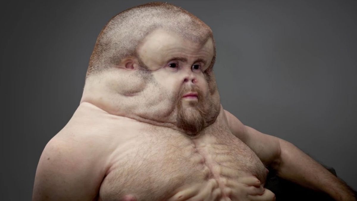 Face and chest of Graham, a mutant superhuman that could survive a high-speed car crash