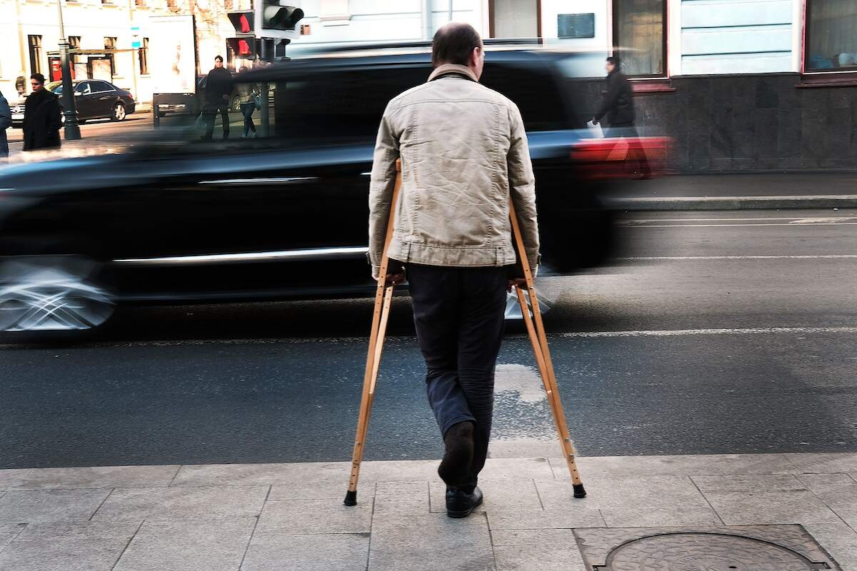 Can You Drive With Only 1 Leg?