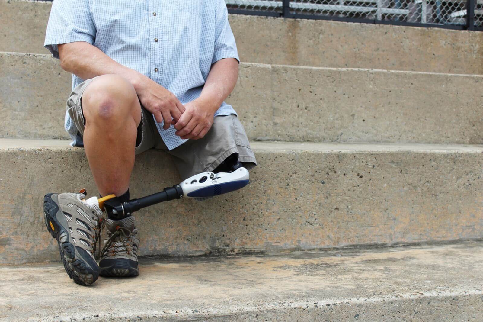 An amputee with one leg sits on steps.