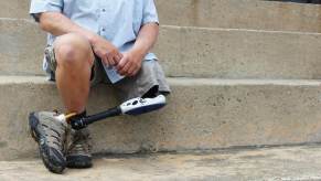 An amputee with one leg sits on steps.